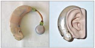 examples of original hearing aids developed in the mid 1900s