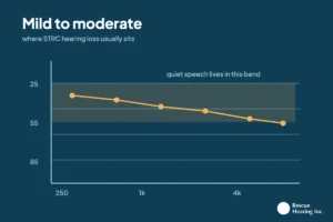 An audiogram with the mild to moderate band shaded, a plotted line sloping gently from 250 hertz to the high frequencies, labelled quiet speech lives in this band