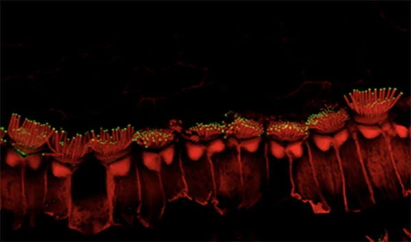 Microscopic image showing stereocilia, the tiny hair-like projections on inner-ear sensory hair cells, in a mouse model.